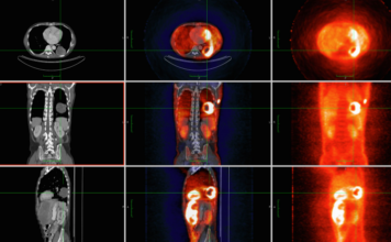 What is a PET Scan? The Best Vital Imaging Technique What is a PET Scan The Best Vital Imaging Technique